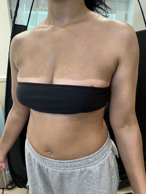 Tan line contrast on a client photographed in the Sunkiss Studios spray tent